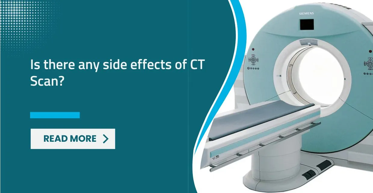 Is There Any Side Effects of CT Scan?