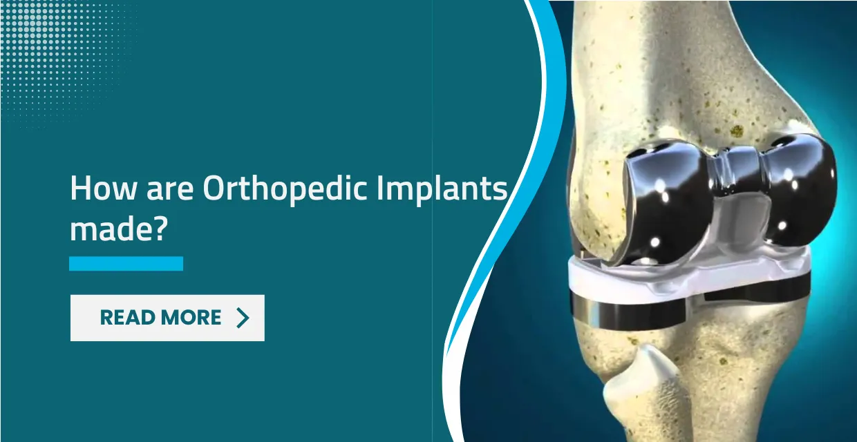 Engineering for the Body: The Science Behind Orthopedic Implants