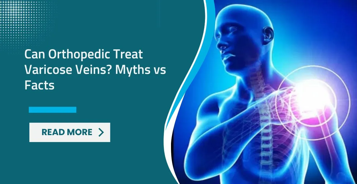 Can an Orthopedic Surgeon Treat Varicose Veins? Clarifying Leg Pain Care