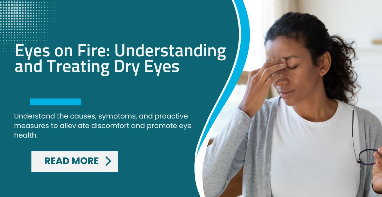 Eyes on Fire? A Comprehensive Guide to Managing Dry Eye Syndrome