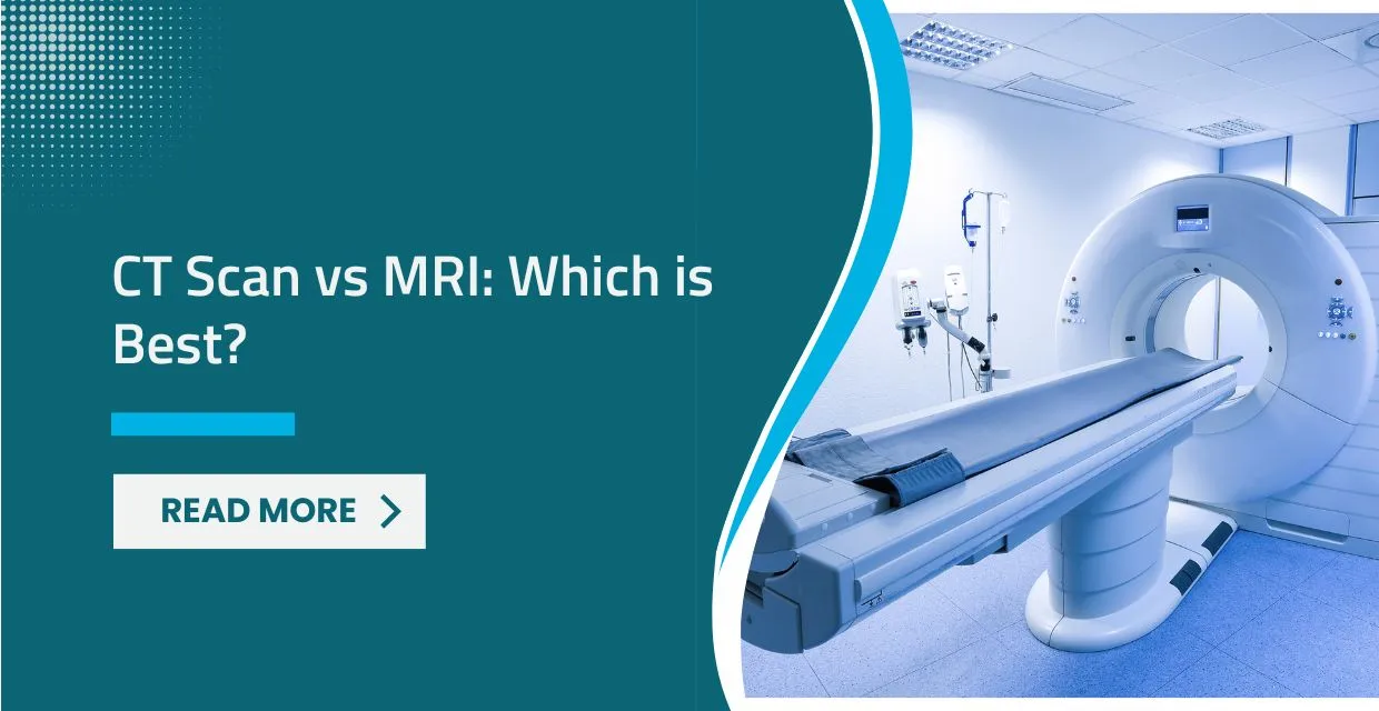 CT Scan vs MRI: Which is Best?