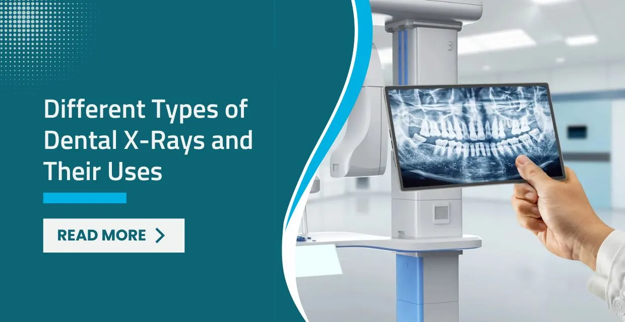 Different Types of Dental X-rays and Why They Matter