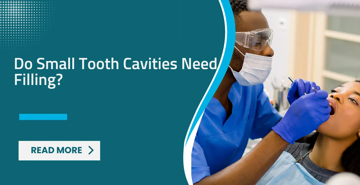 Do Small Tooth Cavities Really Need Filling? The Case for Early Intervention