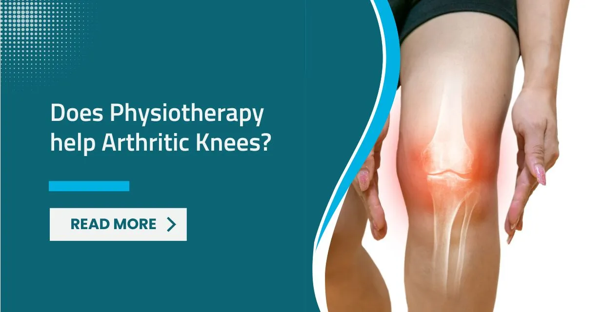 Does Physiotherapy Help Arthritic Knees? Benefits and Techniques