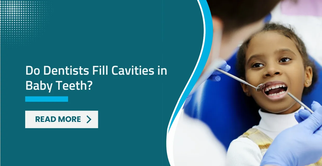 Do Dentists Fill Cavities in Baby Teeth? Why It Matters