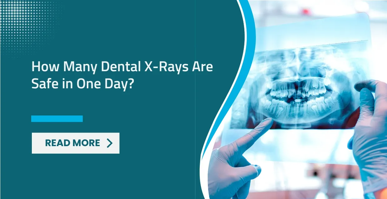 How Many Dental X-rays Are Safe in One Day?